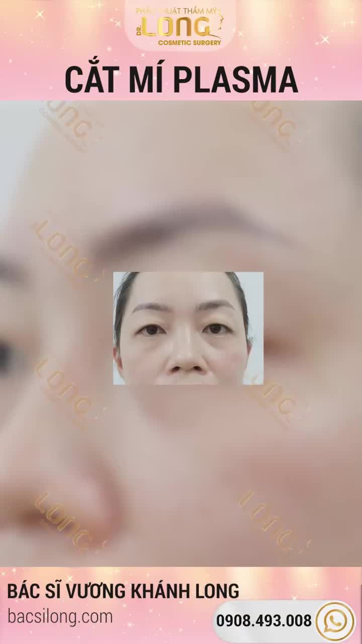 ĐẸP THẬT LÂU VỚI ĐÔI MẮT 2 MÍ ĐẸP ĐẬM SÂU
